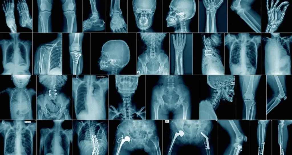 Міжнародний день радіології (Всесвітній день радіографії)