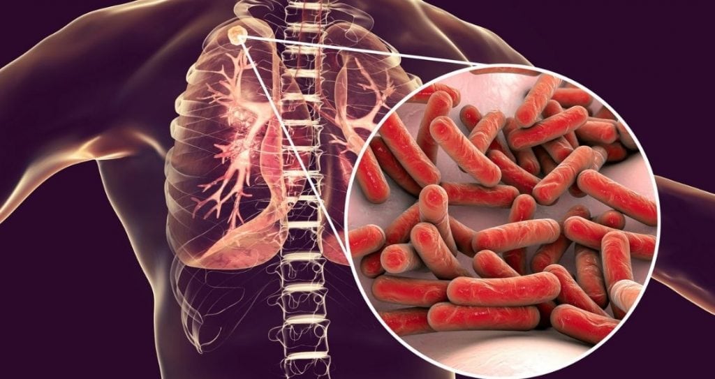 Всеукраїнський день боротьби із захворюванням на туберкульоз