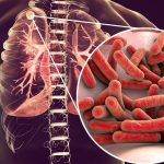 Всеукраїнський день боротьби із захворюванням на туберкульоз