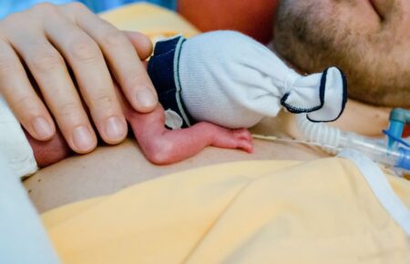 Міжнародний день поінформованості про метод «кенгуру» у виходженні недоношених дітей