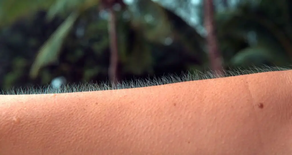 фрісон, мурашки на шкірі