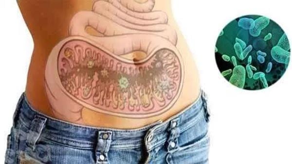 дисбактеріоз