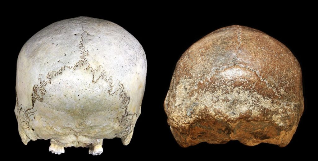 skull comparison